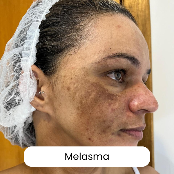 Consultoria de Skincare Personalizada Online com Jacqueline Milani