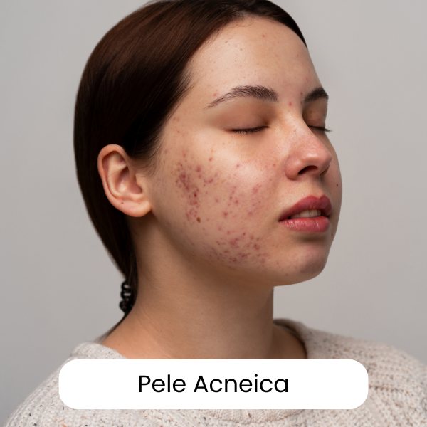 Consultoria de Skincare Personalizada Online com Jacqueline Milani